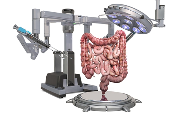 How Robotic Surgery Is Transforming Colorectal Procedures