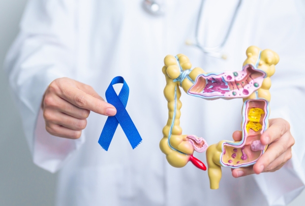 When Should You Get Your First Colonoscopy? Updated Guidelines Made Simple
